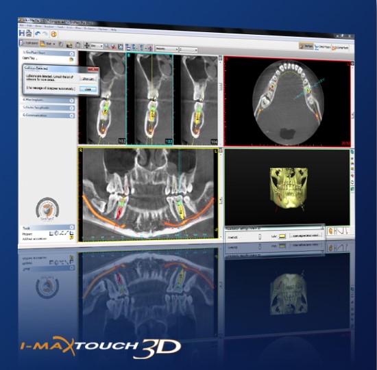 I -Max Touch 3D Digital Panoramic Dental X-Ray System
