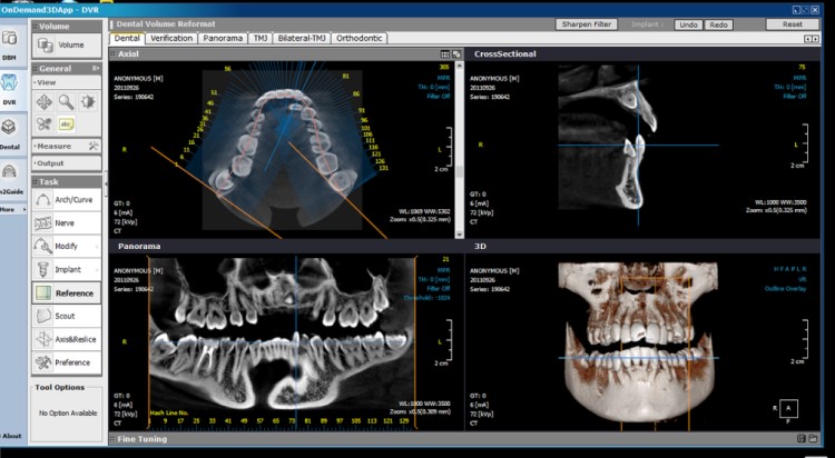Rotograph EVO 3D CBCT 3-in-1 Imaging Unit