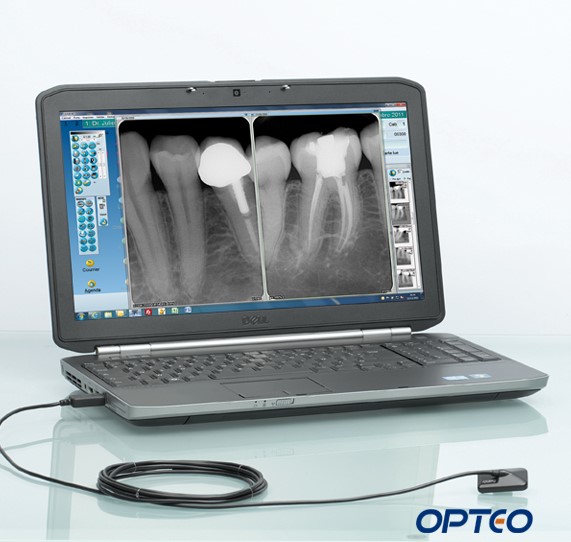 Owandy Opteo Dental Digital X-Ray Sensors