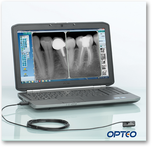 Owandy Opteo Digital X-Ray Sensor System