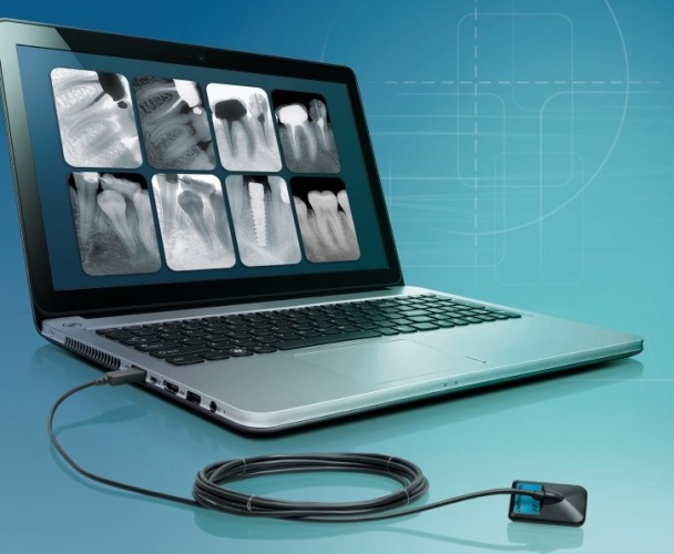 Videograph HD IntraOral Digital X-Ray Sensors