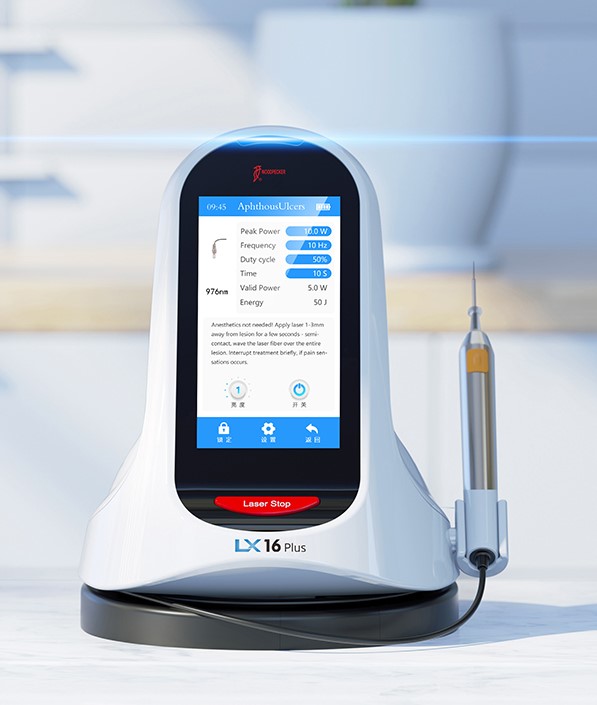 WoodPecker LX16 Plus Diode Dental Soft Tissue Laser