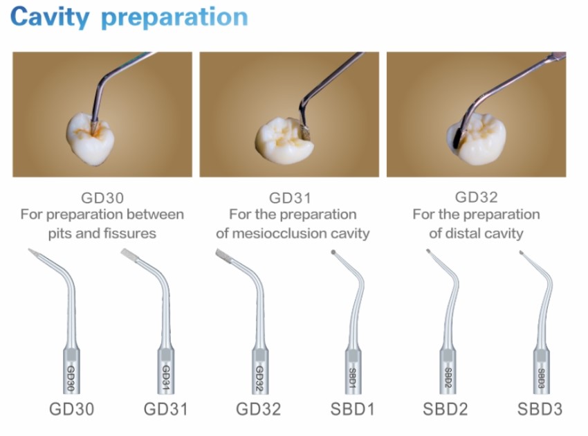 WoodPecker DTE S6 LED Piezo Scaler Cavity Preparation Tips