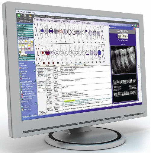 DentaMax Dental Digital X-Ray Sensor Imaging Software