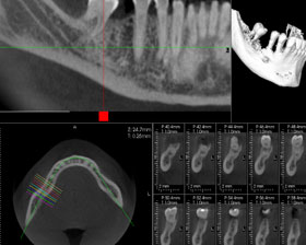 Sky View TomoGraph Panoramic/ TMJ/ and Ceph Unit