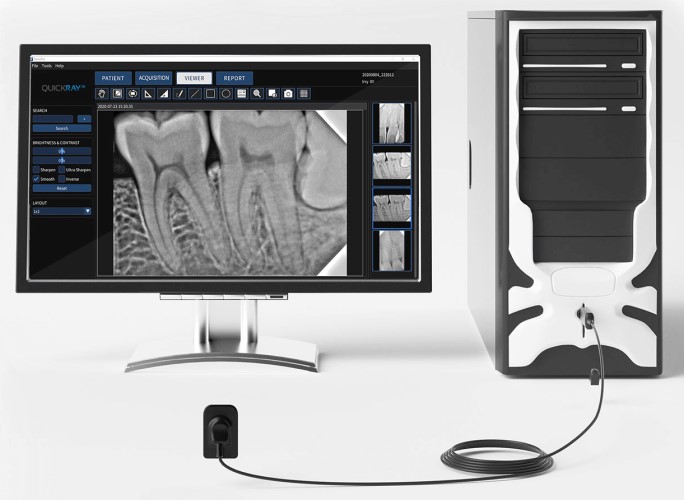 My Ray X- Pod Wireless Digital X-Ray Sensor Sample Picture