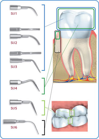 Universal Piezo Scaling Tips