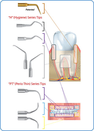 Perio Ultrasonic Piezo Scaler Tips