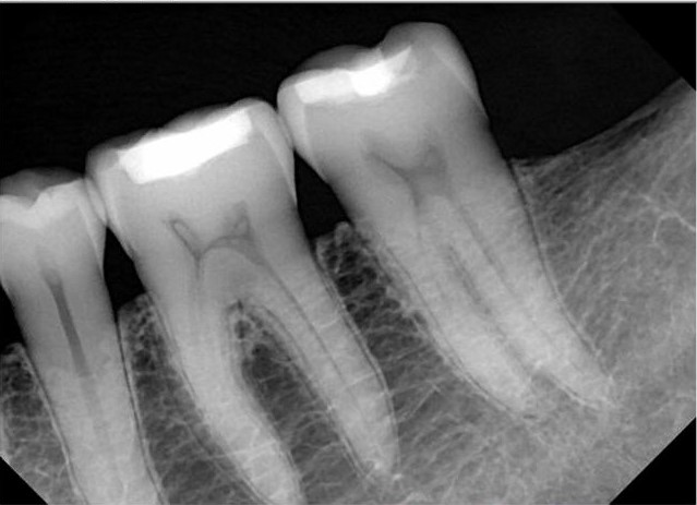 QuickRay Pro Digital Dental Imaging Sensors