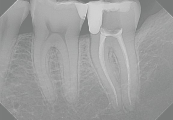 Kavo Nomad Pro 2 Dental Hand Held X-Ray Unit