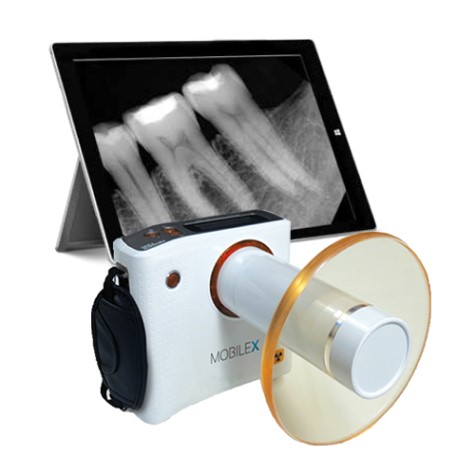 Mobile-X Remex T-100 Handheld Dental X-Ray Generator