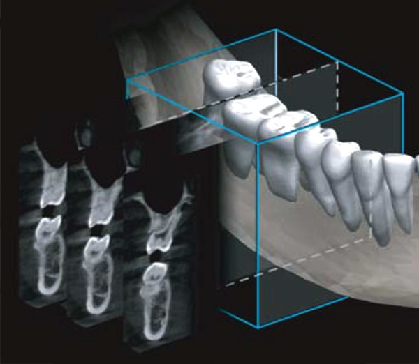 Papaya Plus Panoramic 2-In-1 Dental X-ray Imaging system 