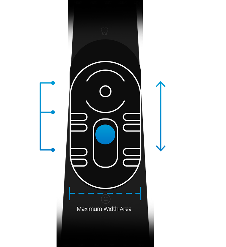 Ambidextrous Slide-Focus and Capture Button on Claris i5HD Intraoral Camera