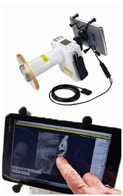 MaxRay Portable Dental Hand-Held Digital X-Ray Unit